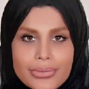 دکتر مهسا کاشفی زاده