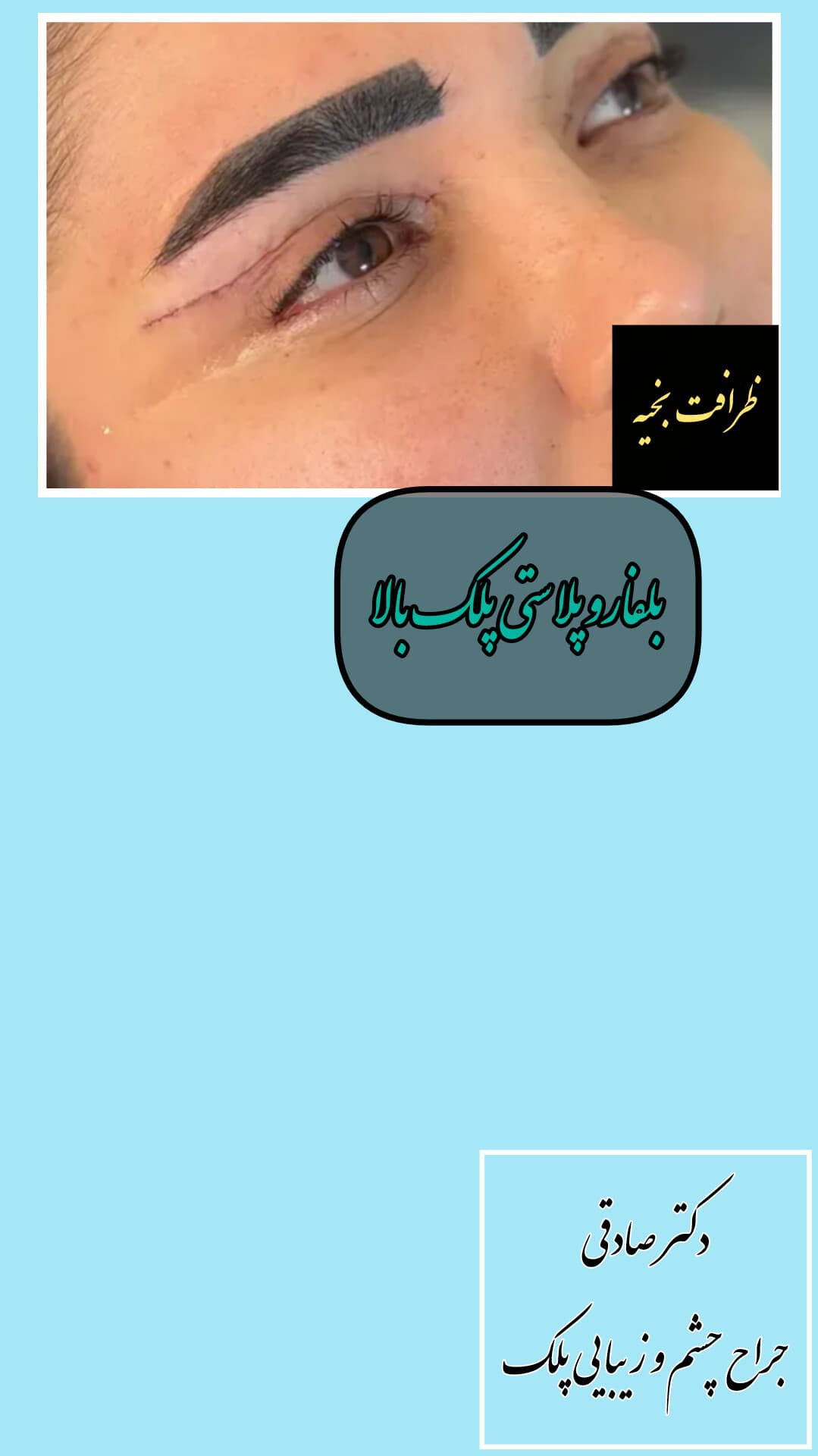 gallery-item