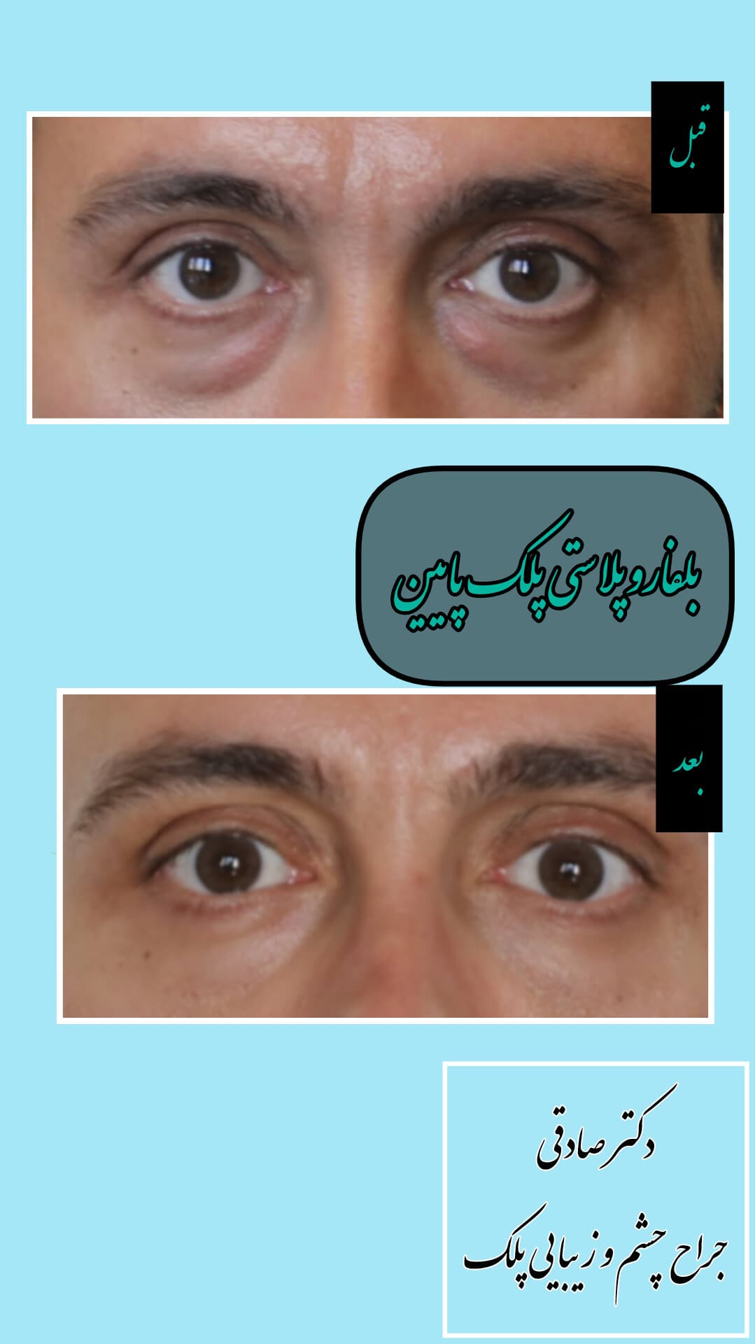 gallery-item