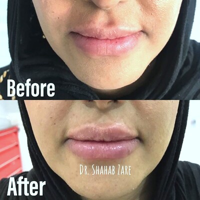 carousel item