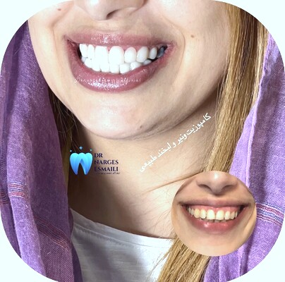 carousel item