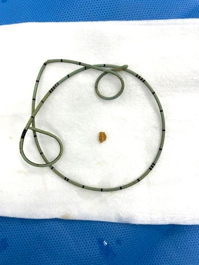 gallery-item