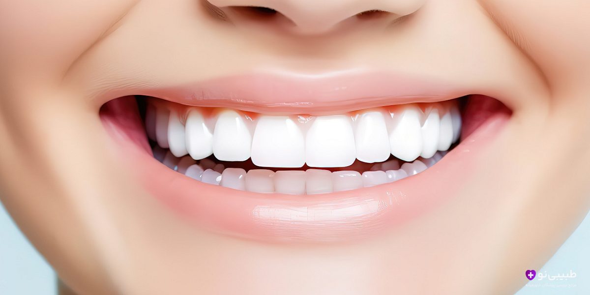 کمبود کدام ویتامین باعث پوسیدگی دندان میشود؟