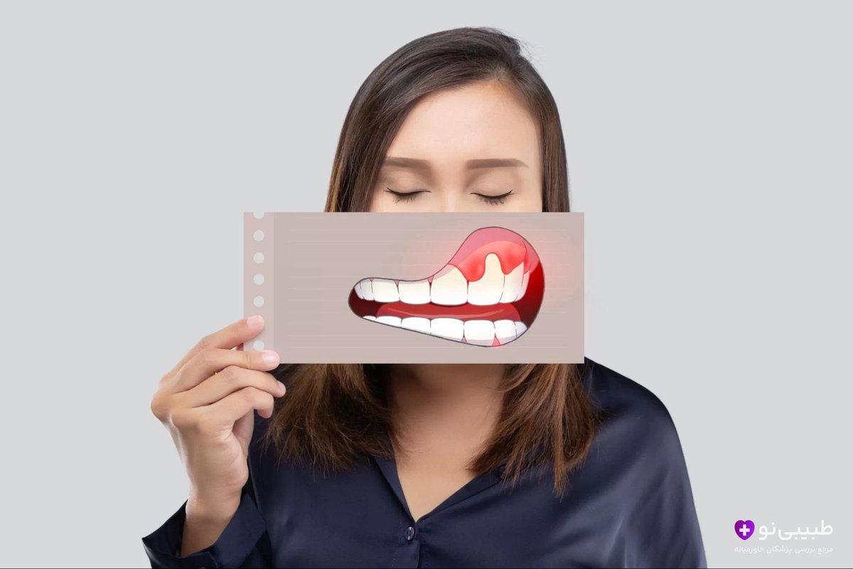درمان التهاب لثه بعد از گذاشتن دندان مصنوعی
