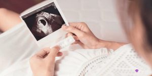 آیا تپش قلب در اوایل بارداری می‌تواند به جنسیت جنین مرتبط باشد؟