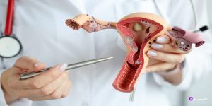 تنبلی تخمدان یا PCOS یکی از شایع‌ترین اختلالات زنان است. در این مطلب با روش‌های درمان، مدت زمان لازم برای بهبود و نکات کلیدی در مدیریت این بیماری آشنا شوید.