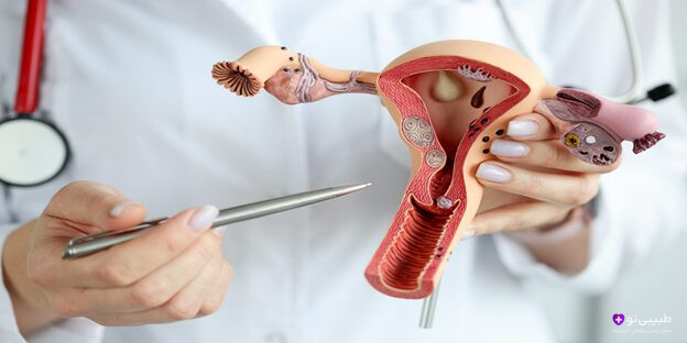 تنبلی تخمدان یا PCOS یکی از شایعترین اختلالات زنان است. در این مطلب با روشهای درمان، مدت زمان لازم برای بهبود و نکات کلیدی در مدیریت این بیماری آشنا شوید.