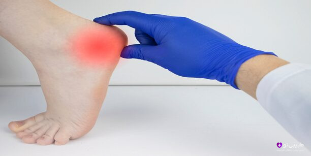 درد پاشنه پا حسابی کلافهکنندهست! بیا با هم دلایل اصلیش رو بررسی کنیم و ببینیم چطوری میشه راحتترش کرد.