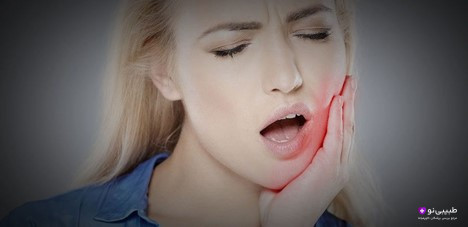 ورم بعد از ایمپلنت دندان معمولاً ۳ تا ۷ روز طول میکشد