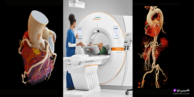 اصطلاحات رایج در سیتی آنژیوگرافی قلب به زبان ساده همراه با تصویر شماتیک قلب و رگها