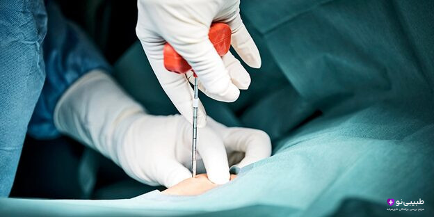 شاوره پزشکی قبل از اهدای مغز استخوان برای کاهش عوارض جانبی