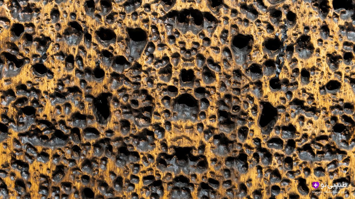 تصویر تریپوفوبیا - سوراخهای خوشهای که باعث حال بد و مورمور شدن خیلیها میشه