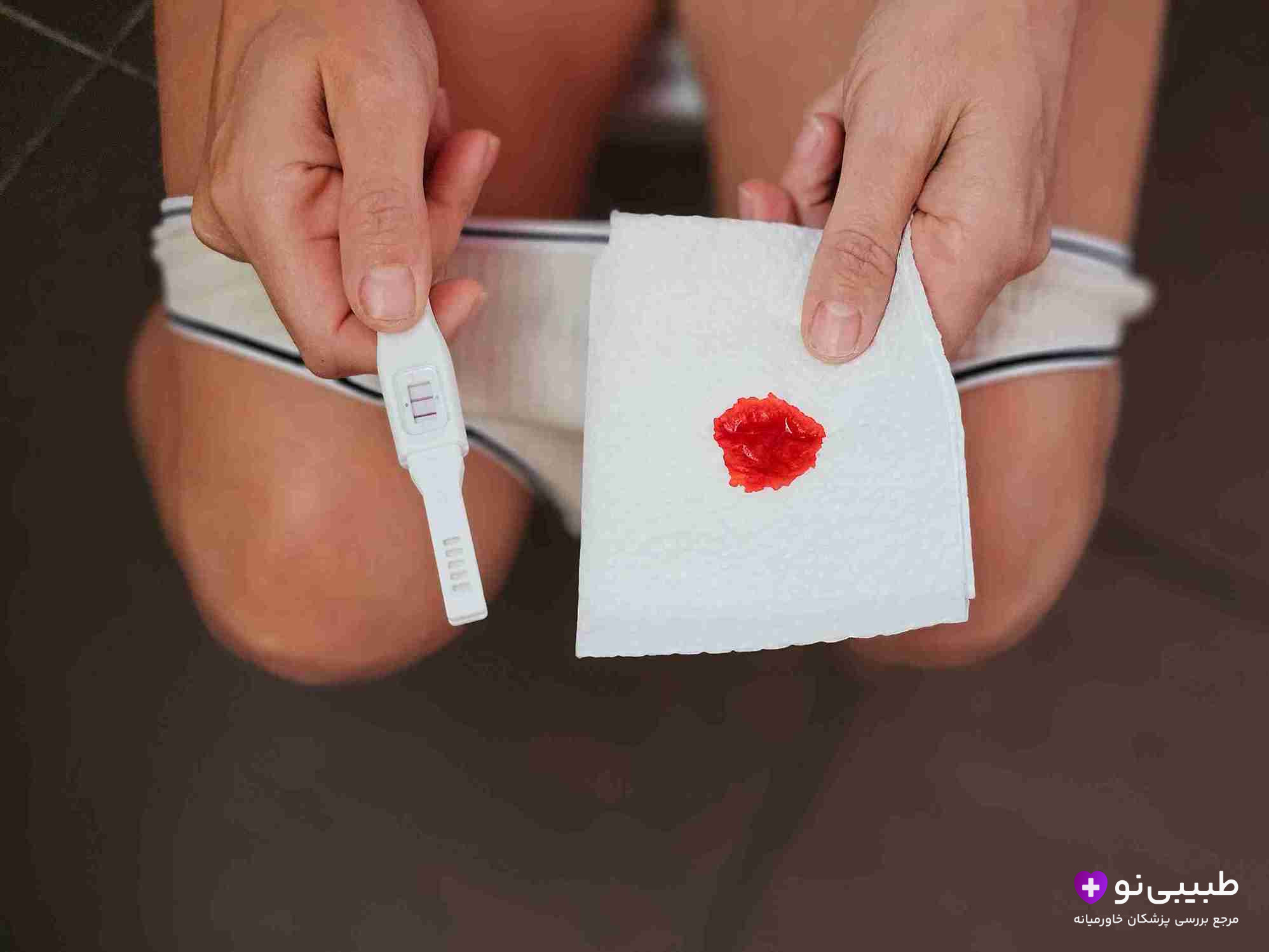 چه مقدار خونریزی در بارداری طبیعی است؟