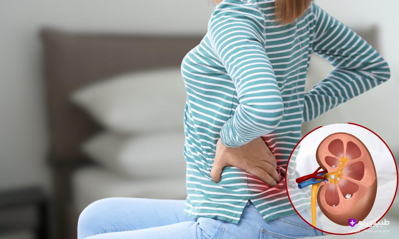 مراقبتهای بعد از سنگ شکن کلیه با لیزر