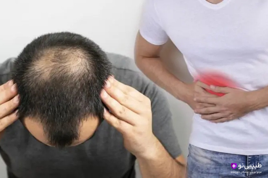 درمان ریزش مو ناشی از کبد چرب