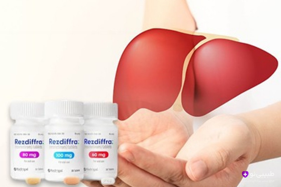 درمان کبد چرب با دارو
