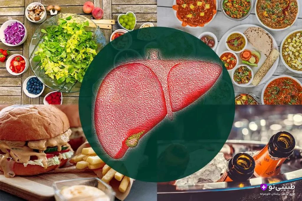 برای کبد چرب چی بخوریم چی نخوریم