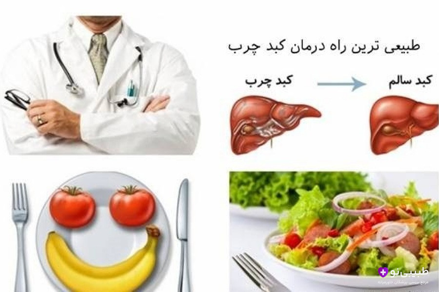 درمان کبد چرب