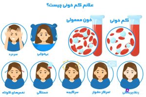 اینفوگرافیک آبی‌رنگ علائم کم خونی با مراحل: استرس (دست روی سر)، بی‌حالی (خوابیدن در تخت)، خون طبیعی (لوله با سلول‌های قرمز سالم)، خون کم‌خونی (لوله با سلول‌های کوچک و کم)، درد گوش (گوش با خط درد)، سردرد (سر با باتری خالی)، سرگیجه (چرخش سر)، گیجی (ابر ابهام) و خستگی (چهره خسته) در زنان جوان با طراحی وکتور