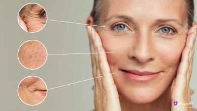 پرتره زن میانسال با پوست صاف و لبخند ملایم؛ سه تصویر زوم‌شده دایره‌ای با خطوط سفید متصل به نواحی چین‌وچروک پیشانی، لک‌های گونه و خطوط اطراف دهان، برای نشان دادن مشکلات رایج پیری پوست که با لیفت صورت قابل درمان هستند.