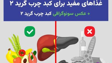 اینفوگرافیک غذاهای مفید (سبزیجات، میوه‌ها، ماهی، کبد سالم) با علامت سبز در مقابل مضر (الکل، نان، برگر، کبد تیره) با علامت قرمز برای پیشگیری از کبد چرب