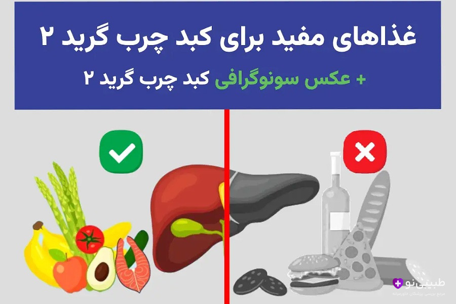 اینفوگرافیک غذاهای مفید (سبزیجات، میوهها، ماهی، کبد سالم) با علامت سبز در مقابل مضر (الکل، نان، برگر، کبد تیره) با علامت قرمز برای پیشگیری از کبد چرب