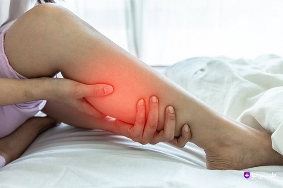 زنی که روی تخت دراز کشیده و پای دردناک خودش رو با دست نگه داشته، با ناحیه قرمز رنگ برای نشان دادن درد