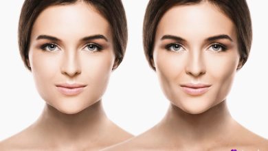 تصویر یک خانم در دو تصویر که نشان دهنده قبل و بعده عمل بوکال فت هستند