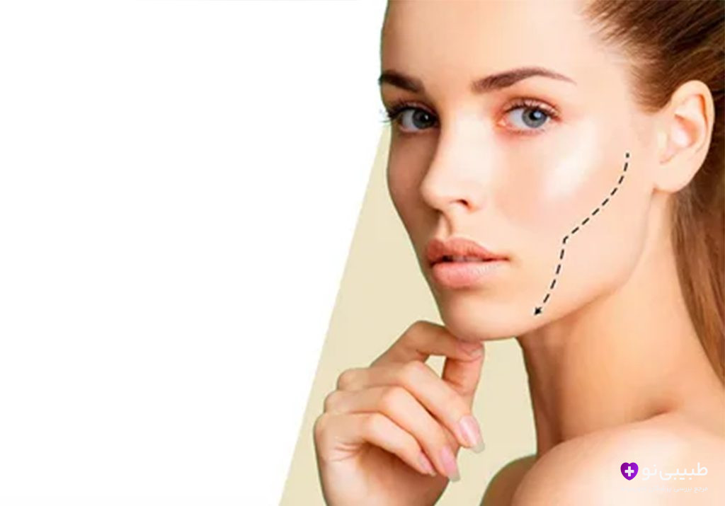 علامت‌گذاری گونه و خط فک برای جراحی بوکال فت ریمووال