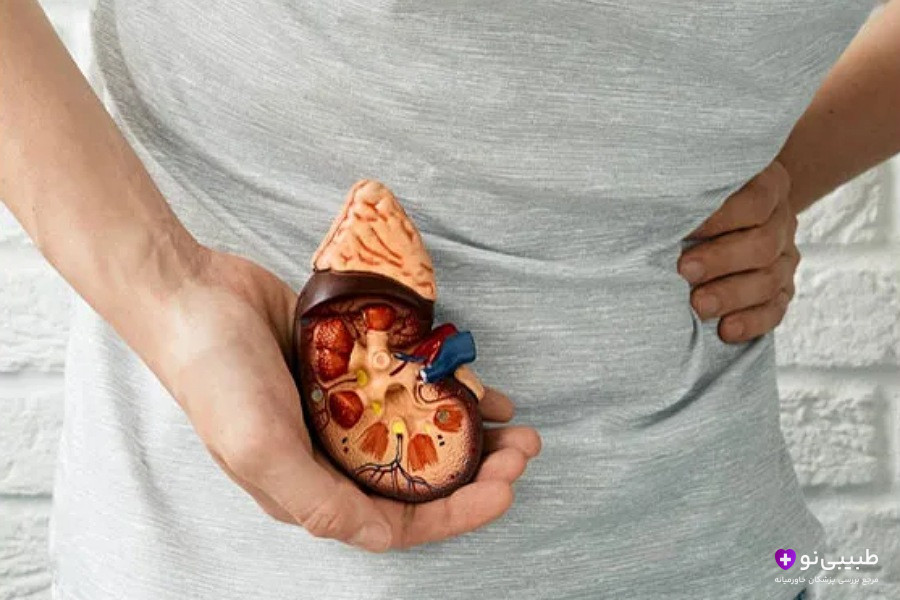 فردی که مدل آناتومی کلیه را در دست نگه داشته و دست دیگر روی ناحیه کمر، نشاندهنده درد کلیوی.