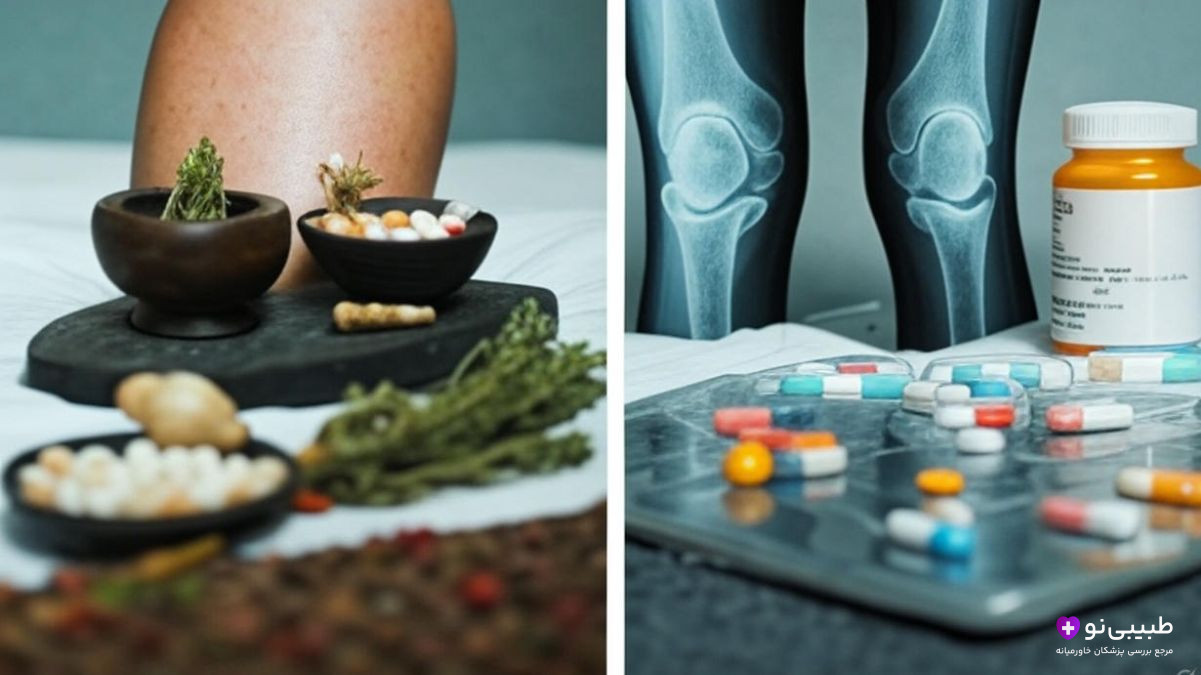 درمان طبیعی آرتروز زانو با گیاهان و ادویه (چپ) vs درمان دارویی با قرص و عکس رادیولوژی (راست)