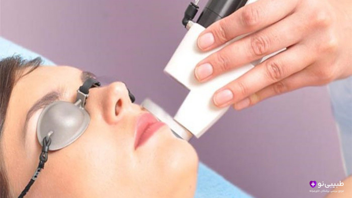 انجام لیفت صورت با لیزر روی بیمار با عینک محافظ چشم در کلینیک زیبایی