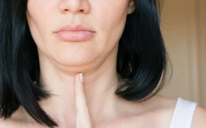 نمای نزدیک از ناحیه غبغب خانم جوان؛ انگشت اشاره روی پوست زیر چانه قرار گرفته و چربی موضعی غبغب را نیشگون گرفته تا میزان حجم و سفتی پوست ارزیابی شود.