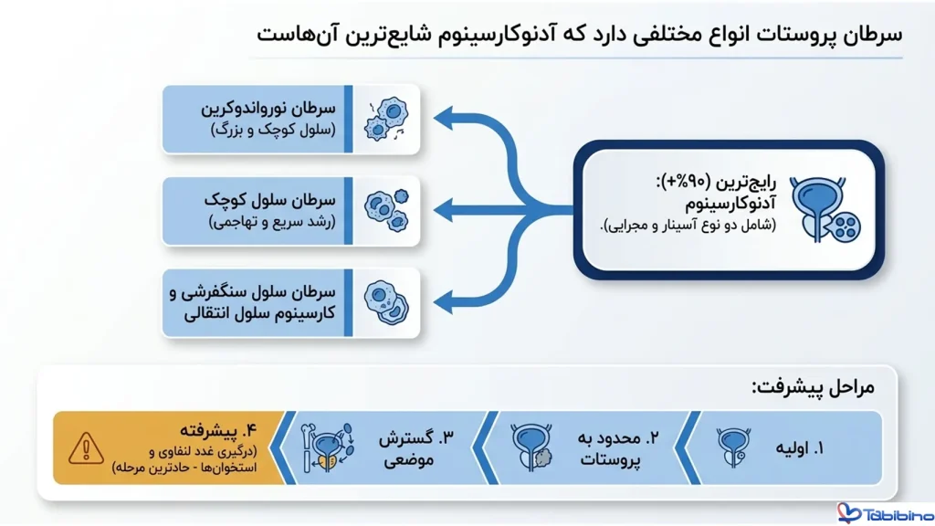 سرطان پروستات کشندست طبیبینو