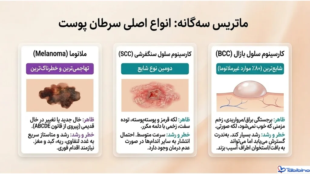 نوعی سرطان پوست در جدول