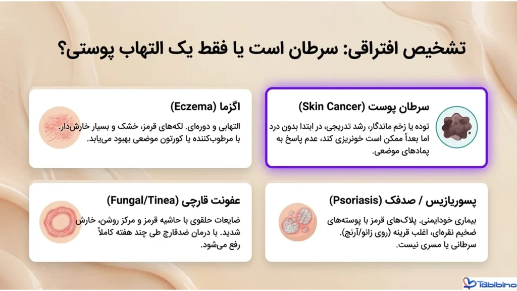 سرطان پوست یعنی چه