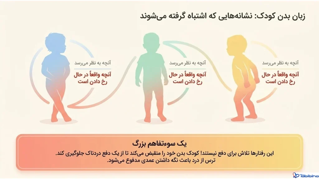 یبوست شدید کودکان درمان