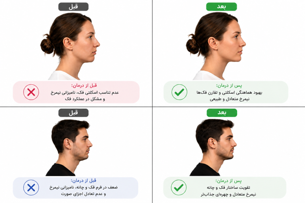 Jaw surgery